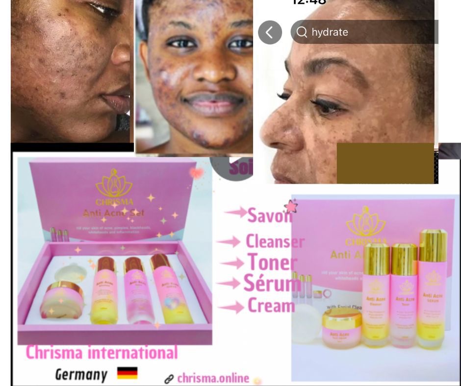 Coffet visage pour imperfections