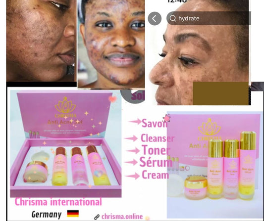 Coffet visage pour imperfections